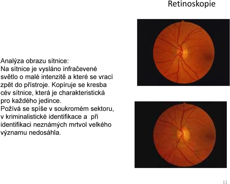 Kopíruje se kresba cév sítnice, která je charakteristická pro každého jedince.