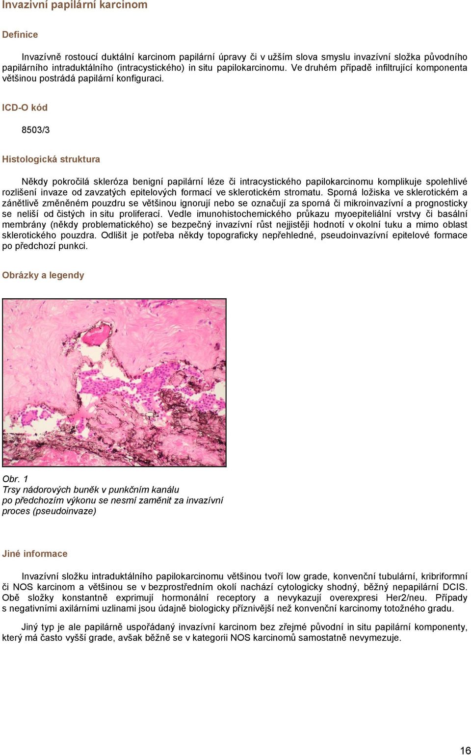 8503/3 Histologická struktura Někdy pokročilá skleróza benigní papilární léze či intracystického papilokarcinomu komplikuje spolehlivé rozlišení invaze od zavzatých epitelových formací ve