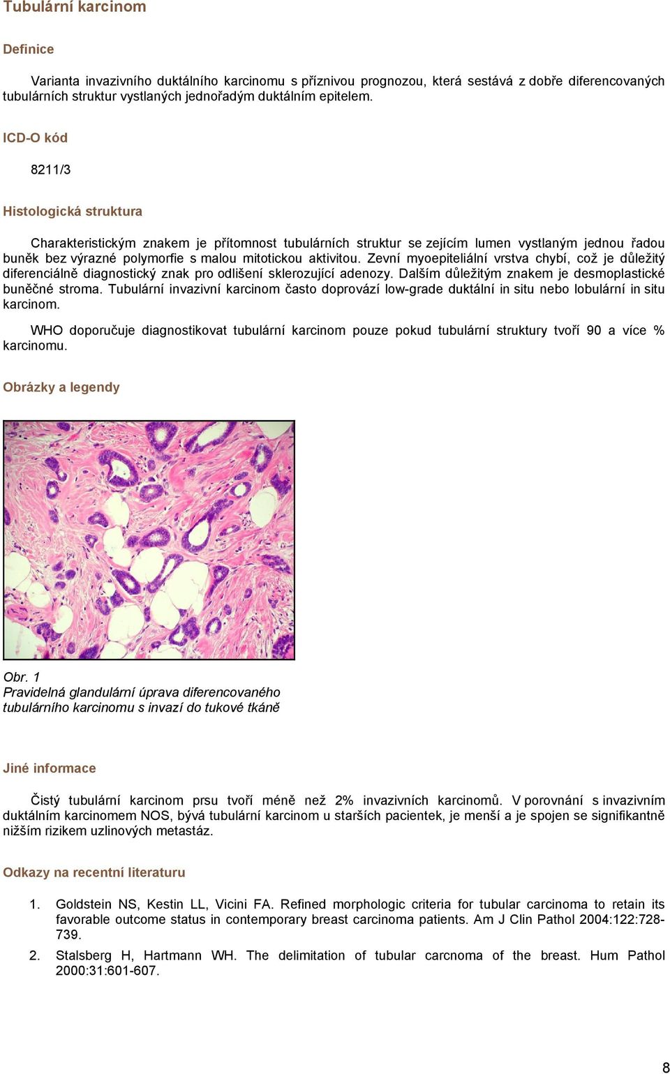 Zevní myoepiteliální vrstva chybí, což je důležitý diferenciálně diagnostický znak pro odlišení sklerozující adenozy. Dalším důležitým znakem je desmoplastické buněčné stroma.