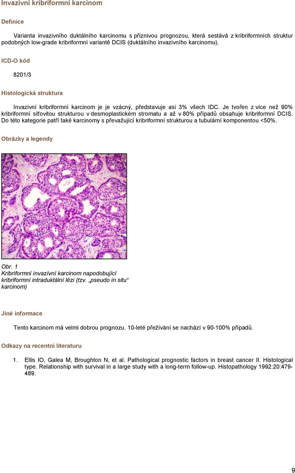 Je tvořen z více než 90% kribriformní síťovitou strukturou v desmoplastickém stromatu a až v 80% případů obsahuje kribriformní DCIS.