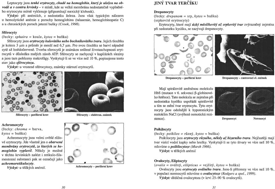 Jsou však typickým nálezem u hemolytické anémie z poruchy hemoglobinu (talasemie, hemoglobinopatie C) a u chronických poruch jaterní buňky (Crook, 1998).