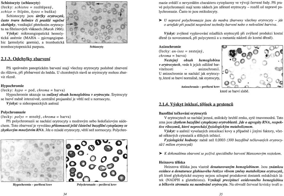 O-:""=;= trombocytopenická purpura. Schizocyty 2.1.3. Odchylky zbarvení Při správném panoptickém barvení mají všechny erytrocyty podobné zbarvení do rů žov á, při přebarvení do hněda.