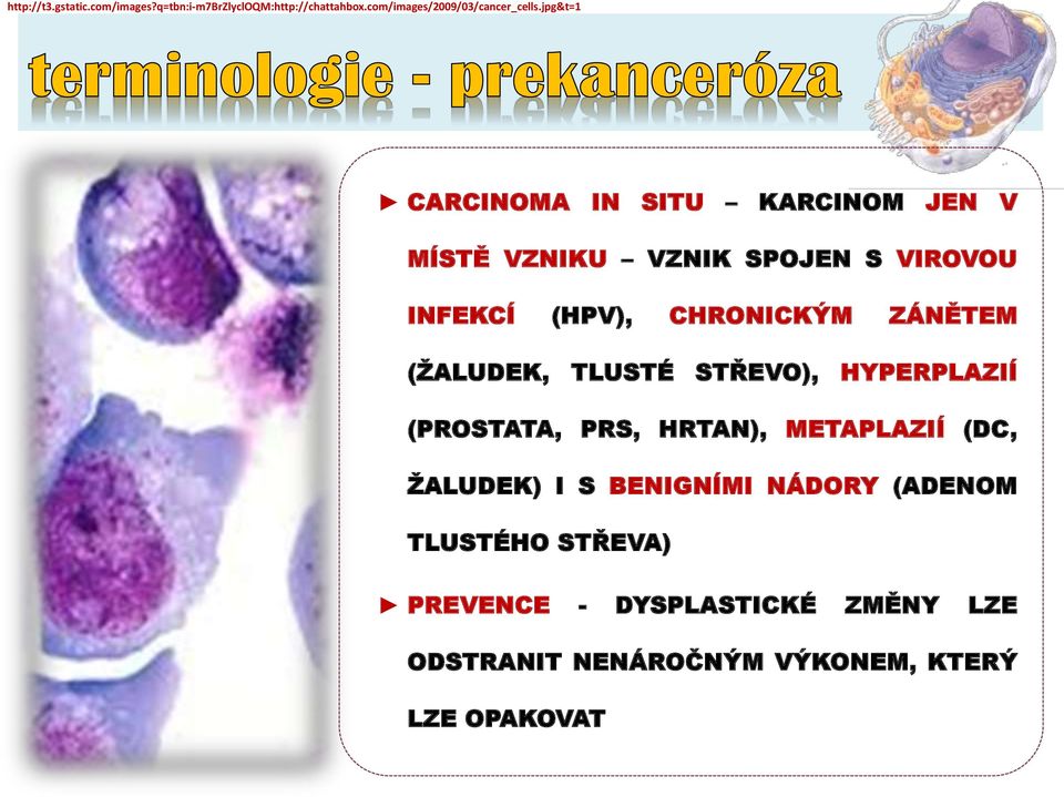 ZÁNĚTEM (ŽALUDEK, TLUSTÉ STŘEVO), HYPERPLAZIÍ (PROSTATA, PRS, HRTAN), METAPLAZIÍ (DC, ŽALUDEK) I S