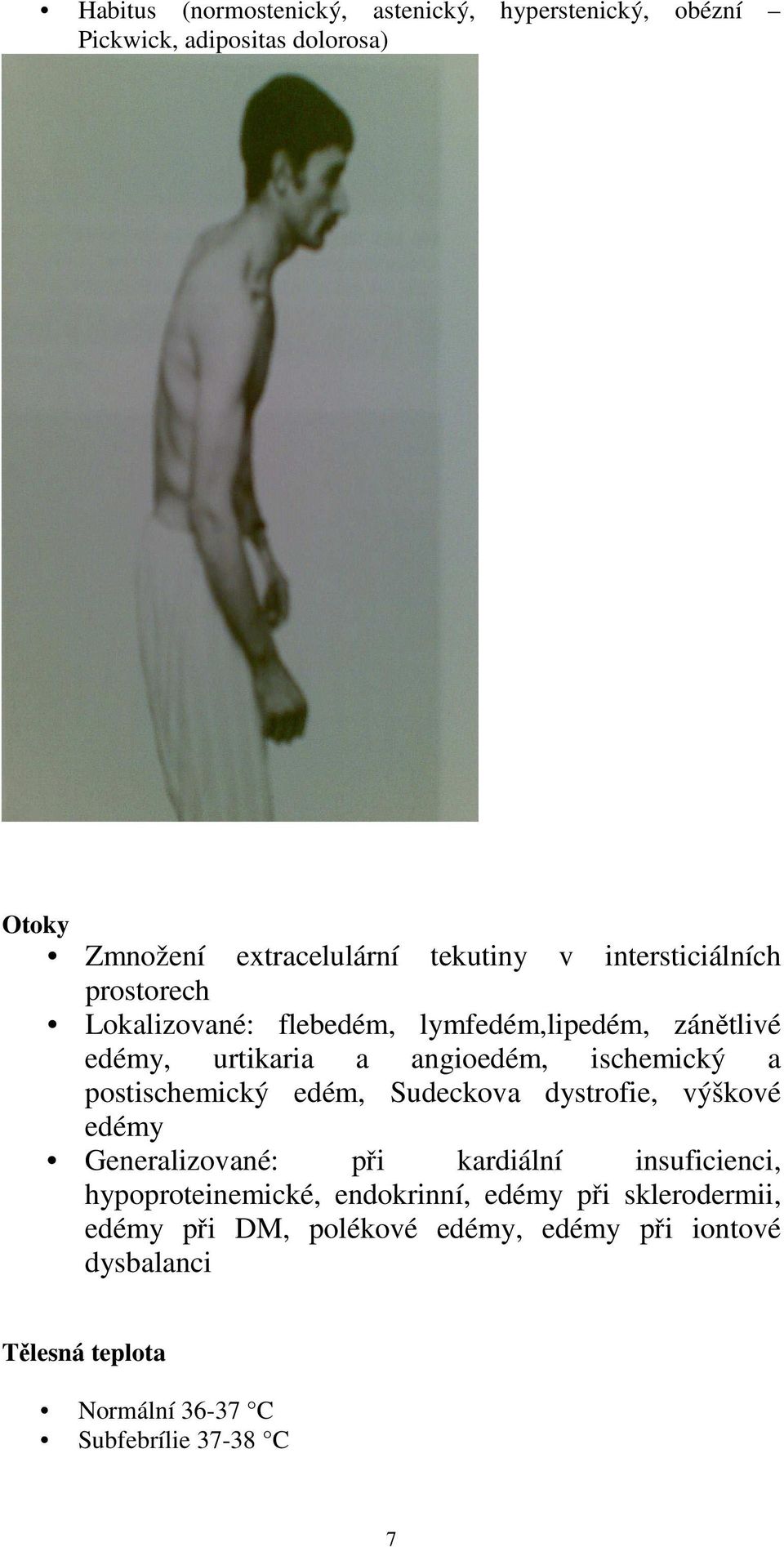 postischemický edém, Sudeckova dystrofie, výškové edémy Generalizované: při kardiální insuficienci, hypoproteinemické,