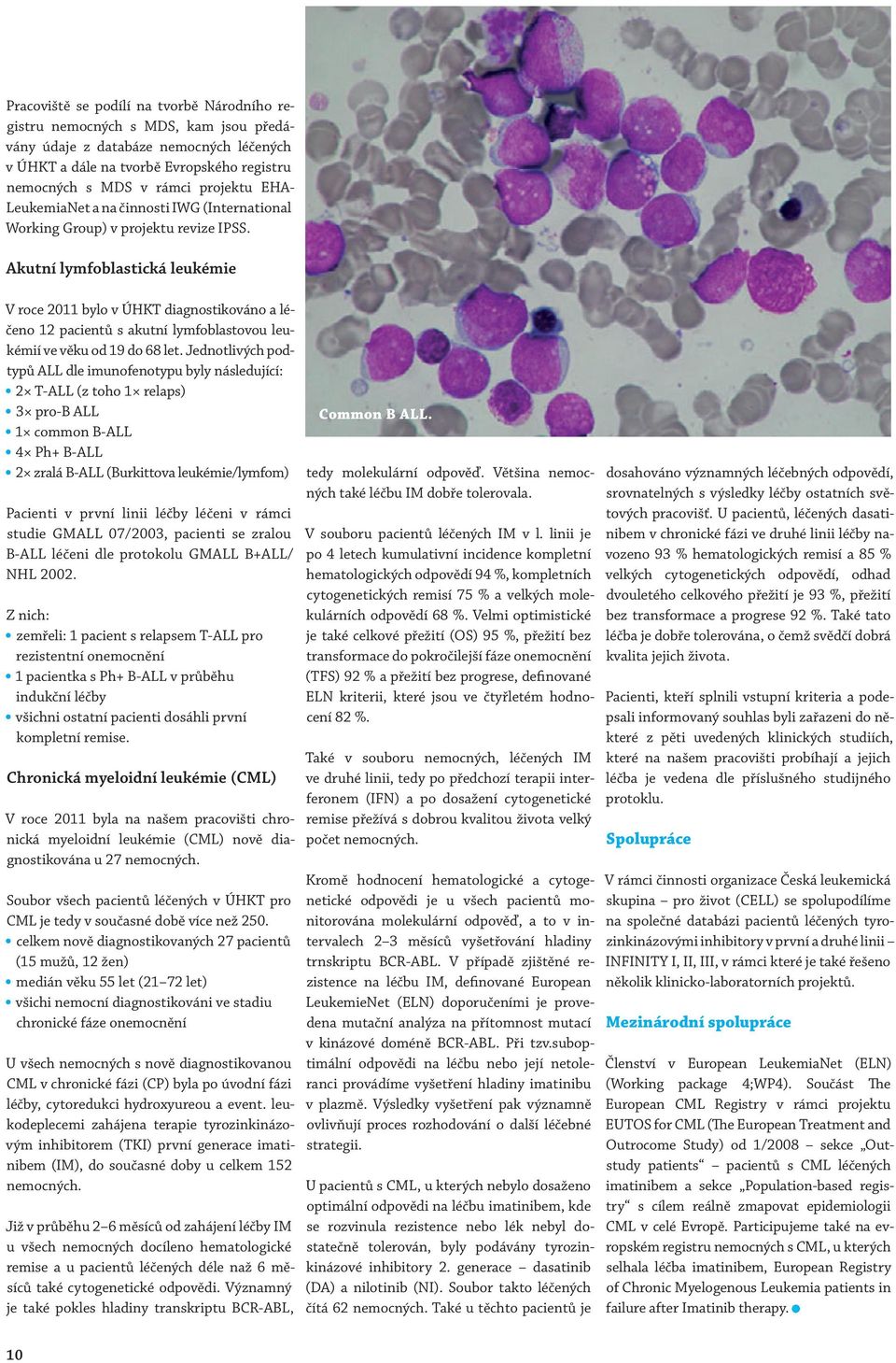 Akutní lymfoblastická leukémie V roce 2011 bylo v ÚHKT diagnostikováno a léčeno 12 pacientů s akutní lymfoblastovou leukémií ve věku od 19 do 68 let.