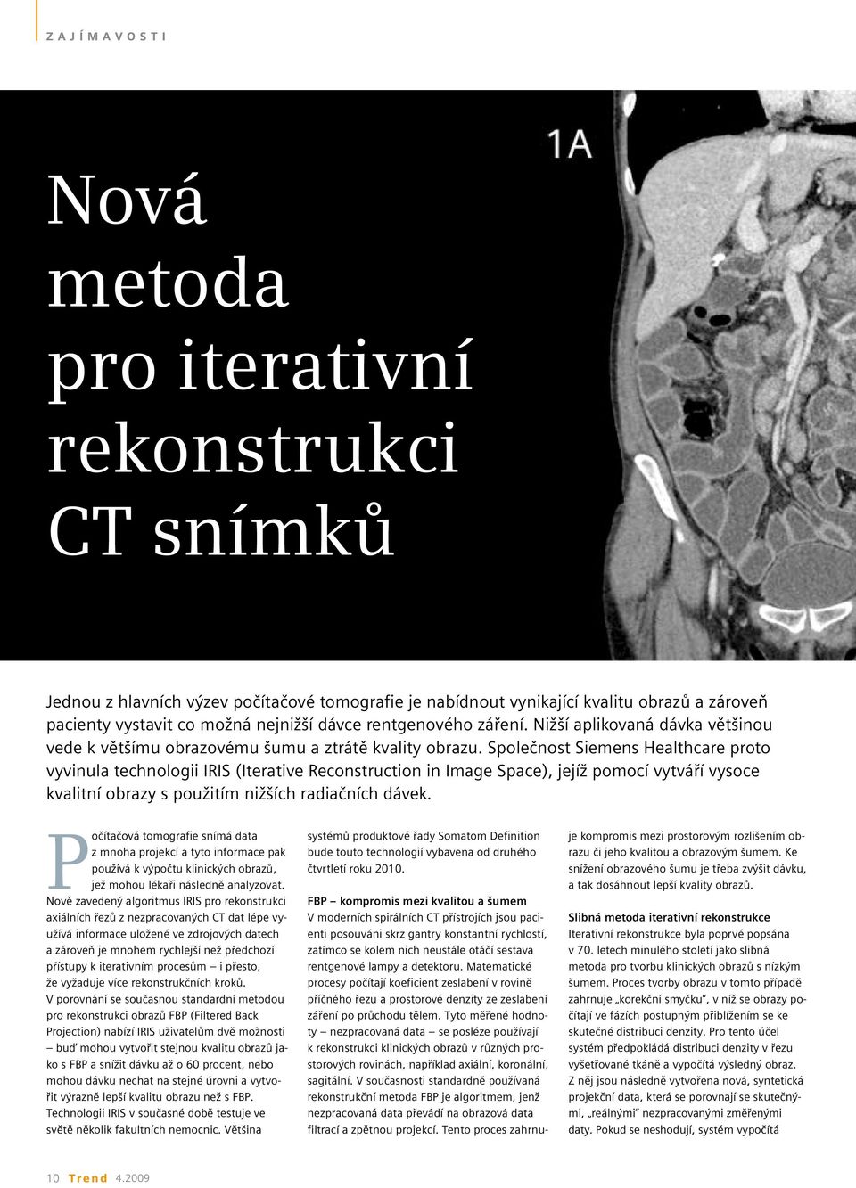 Společnost Siemens Healthcare proto vyvinula technologii IRIS (Iterative Reconstruction in Image Space), jejíž pomocí vytváří vysoce kvalitní obrazy s použitím nižších radiačních dávek.