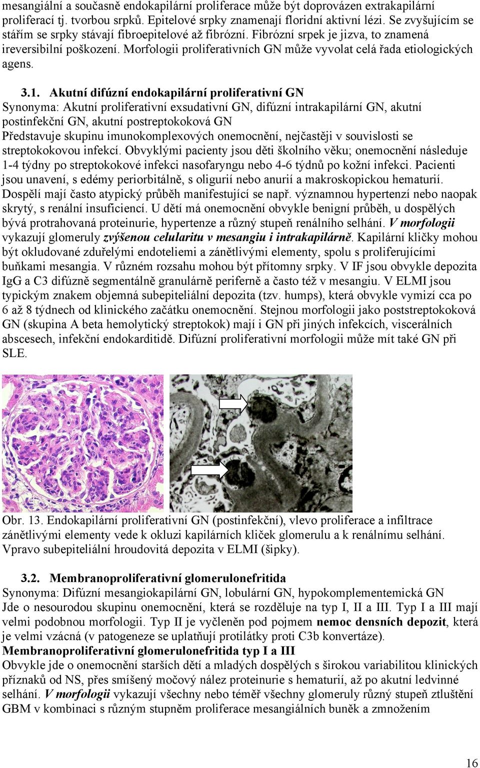 Morfologii proliferativních GN může vyvolat celá řada etiologických agens. 3.1.