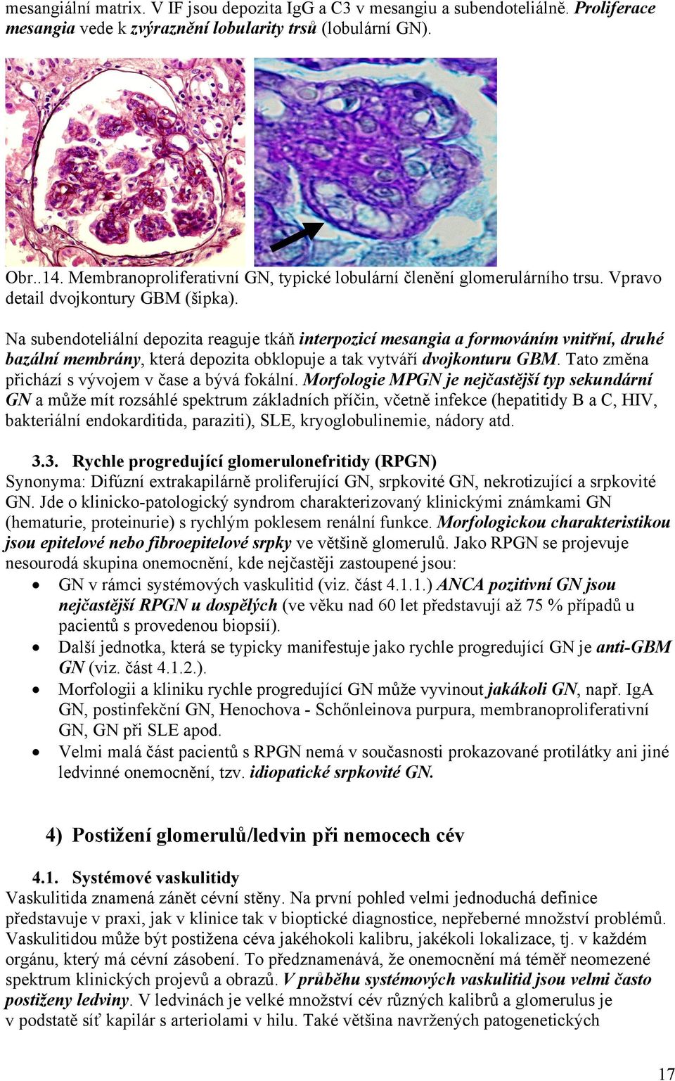 Na subendoteliální depozita reaguje tkáň interpozicí mesangia a formováním vnitřní, druhé bazální membrány, která depozita obklopuje a tak vytváří dvojkonturu GBM.