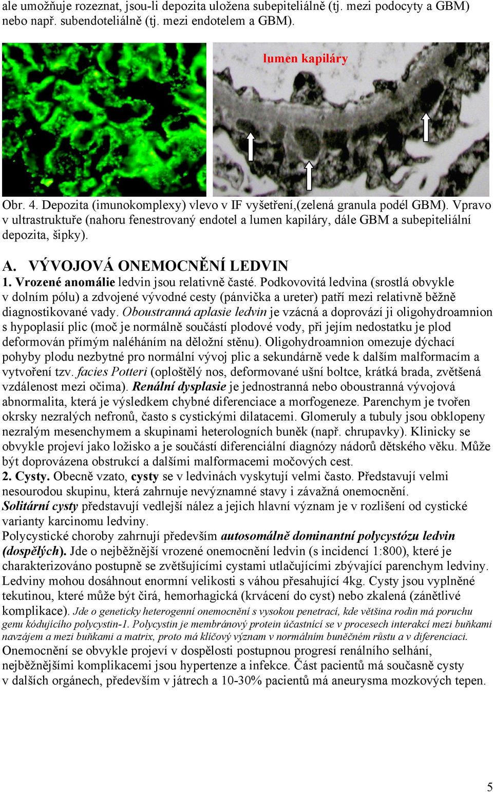 VÝVOJOVÁ ONEMOCNĚNÍ LEDVIN 1. Vrozené anomálie ledvin jsou relativně časté.