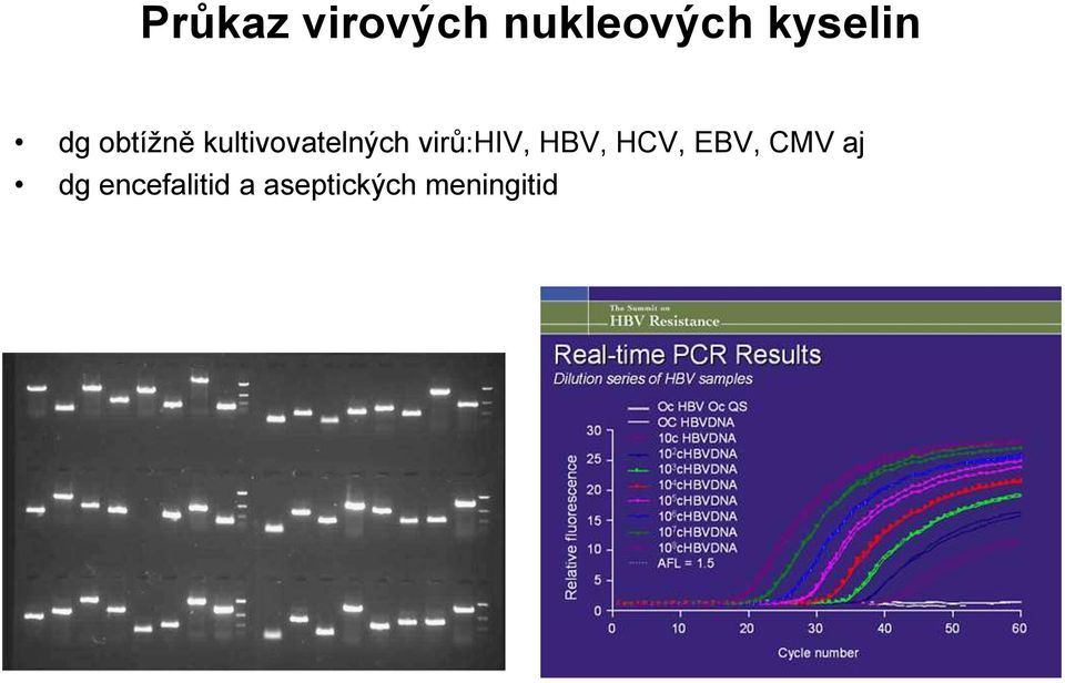 kultivovatelných virů:hiv, HBV,