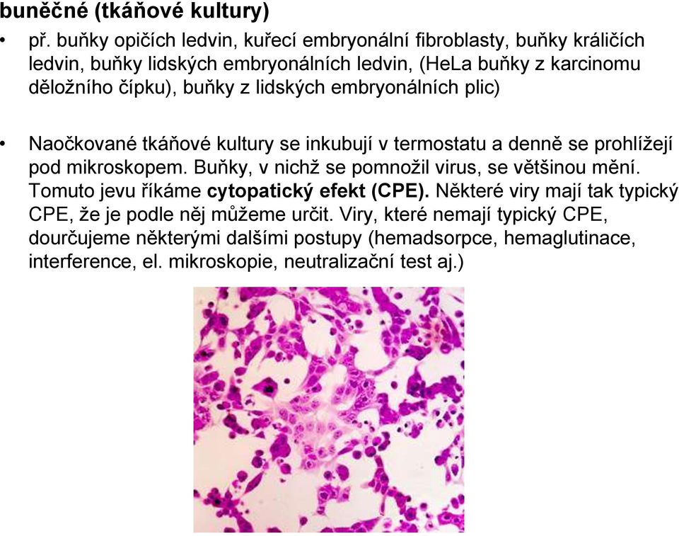 buňky z lidských embryonálních plic) Naočkované tkáňové kultury se inkubují v termostatu a denně se prohlížejí pod mikroskopem.