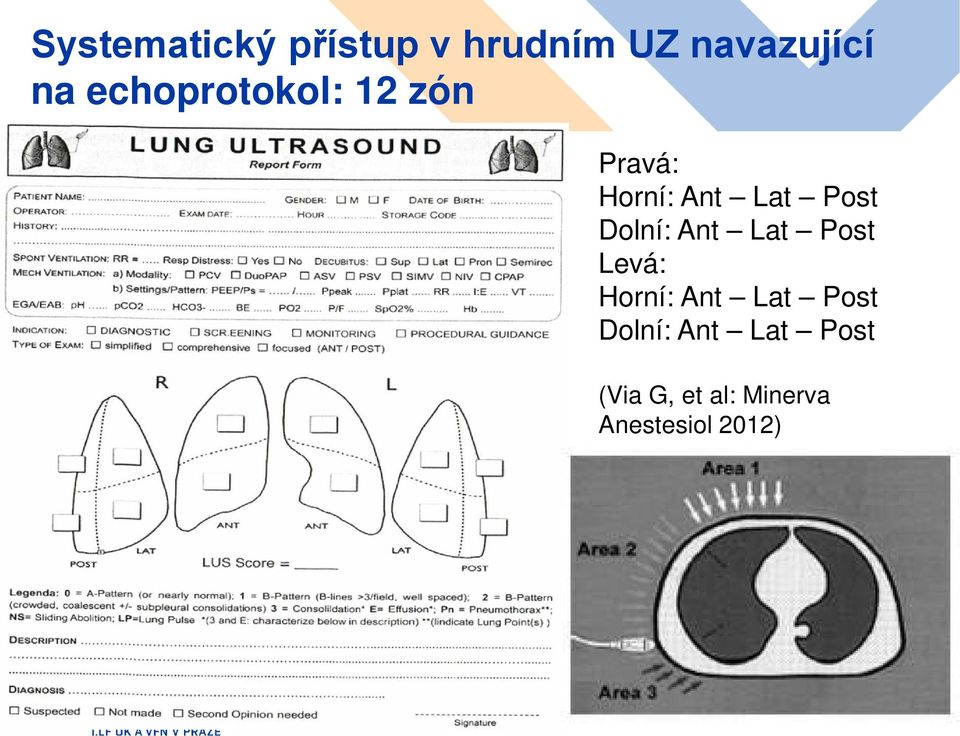 Dolní: Ant Lat Post Levá: Horní: Ant Lat Post