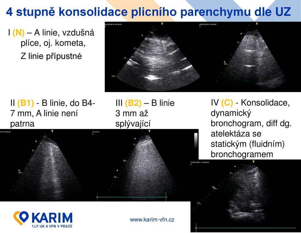 kometa, Z linie přípustné II (B1) - B linie, do B4-7 mm, A linie není