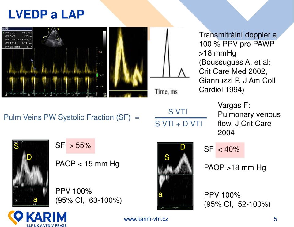 S SF > 55% D PAOP < 15 mm Hg S VTI S VTI + D VTI S D Vargas F: Pulmonary venous flow.