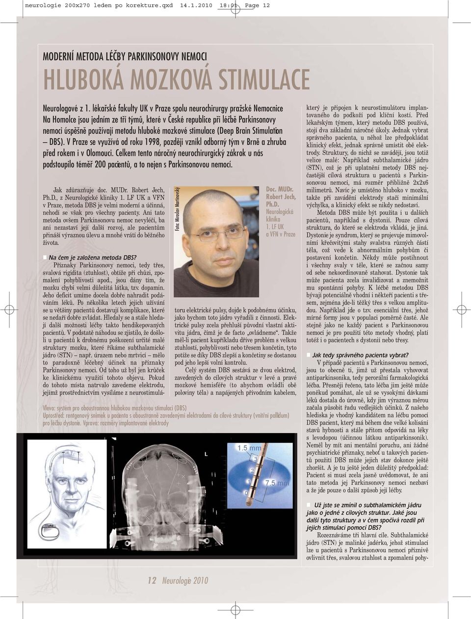 stimulace (Deep Brain Stimulation DBS). V Praze se využívá od roku 1998, později vznikl odborný tým v Brně a zhruba před rokem i v Olomouci.