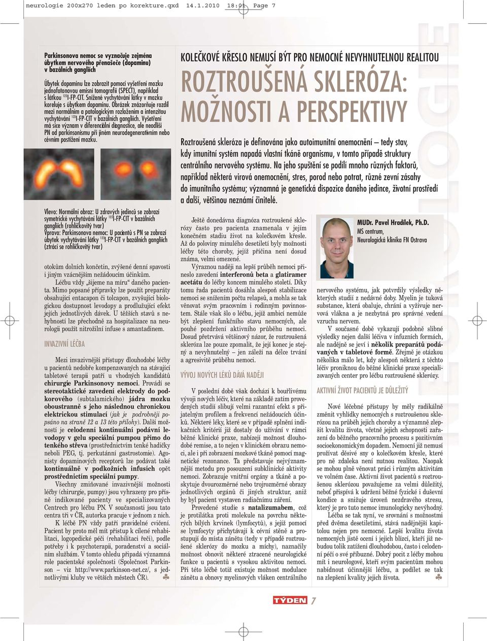 tomografií (SPECT), například s látkou 123 I-FP-CIT. Snížené vychytávání látky v mozku koreluje s úbytkem dopaminu.