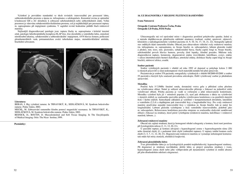 Velká pozornost je věnována subakromioklavikulárnímu prostoru, což je nejdůležitější pro posouzení ruptury m. supraspinatus při impigiment syndromu.