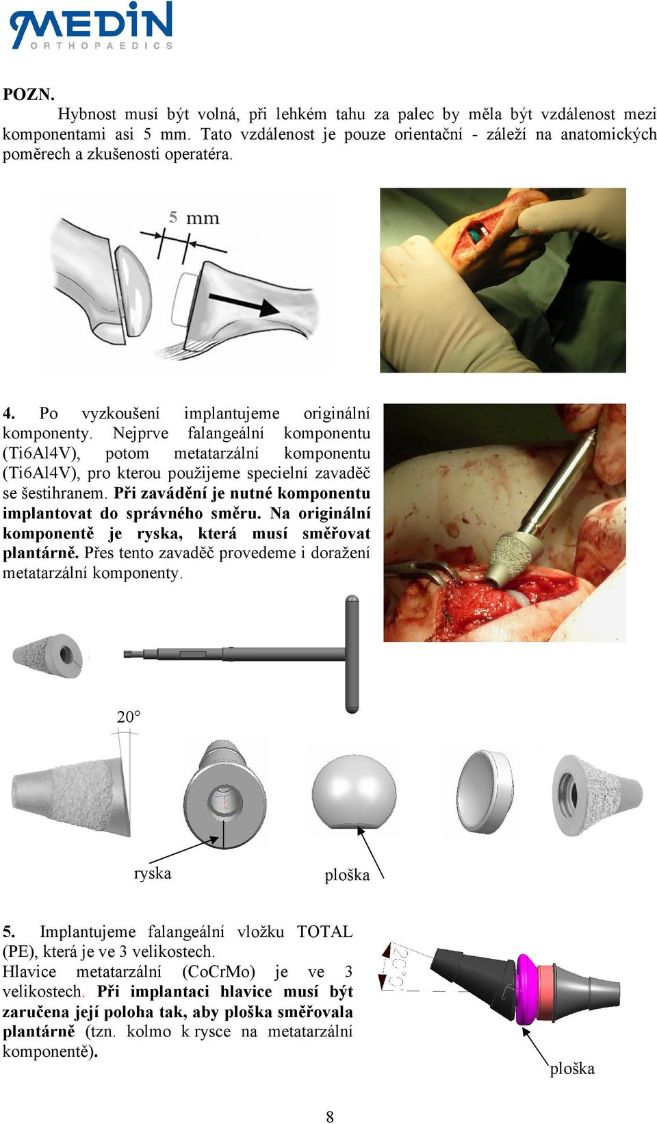 Při zavádění je nutné komponentu implantovat do správného směru. Na originální komponentě je ryska, která musí směřovat plantárně. Přes tento zavaděč provedeme i doražení metatarzální komponenty.