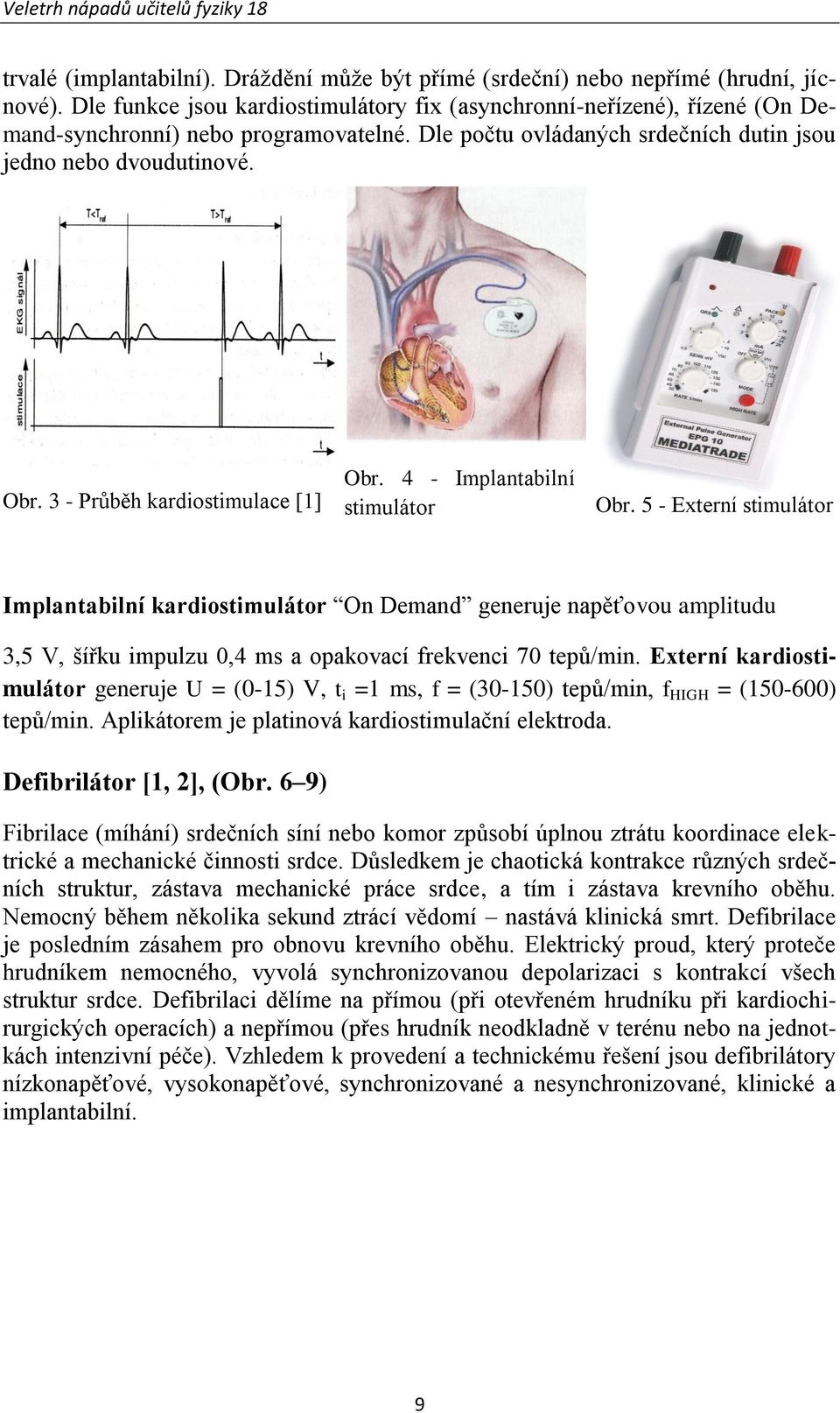 3 - Průběh kardiostimulace [1] Obr. 4 - Implantabilní stimulátor Obr.