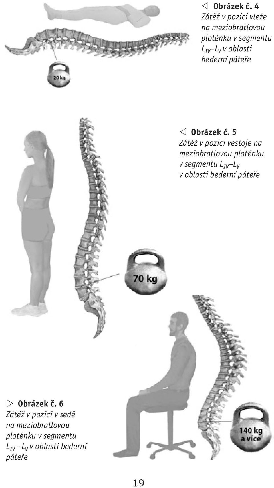 bederní páteře  5 Zátěž v pozici vestoje na meziobratlovou ploténku v segmentu L