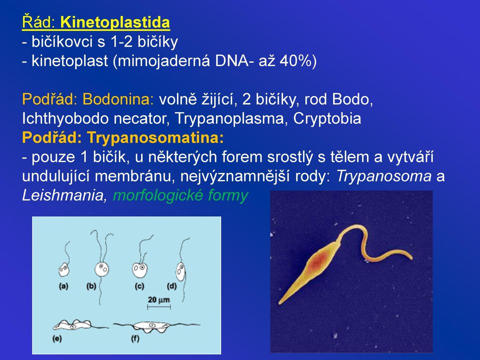 Cryptobia Podřád: Trypanosomatina: - pouze 1 bičík, u některých forem srostlý s tělem a