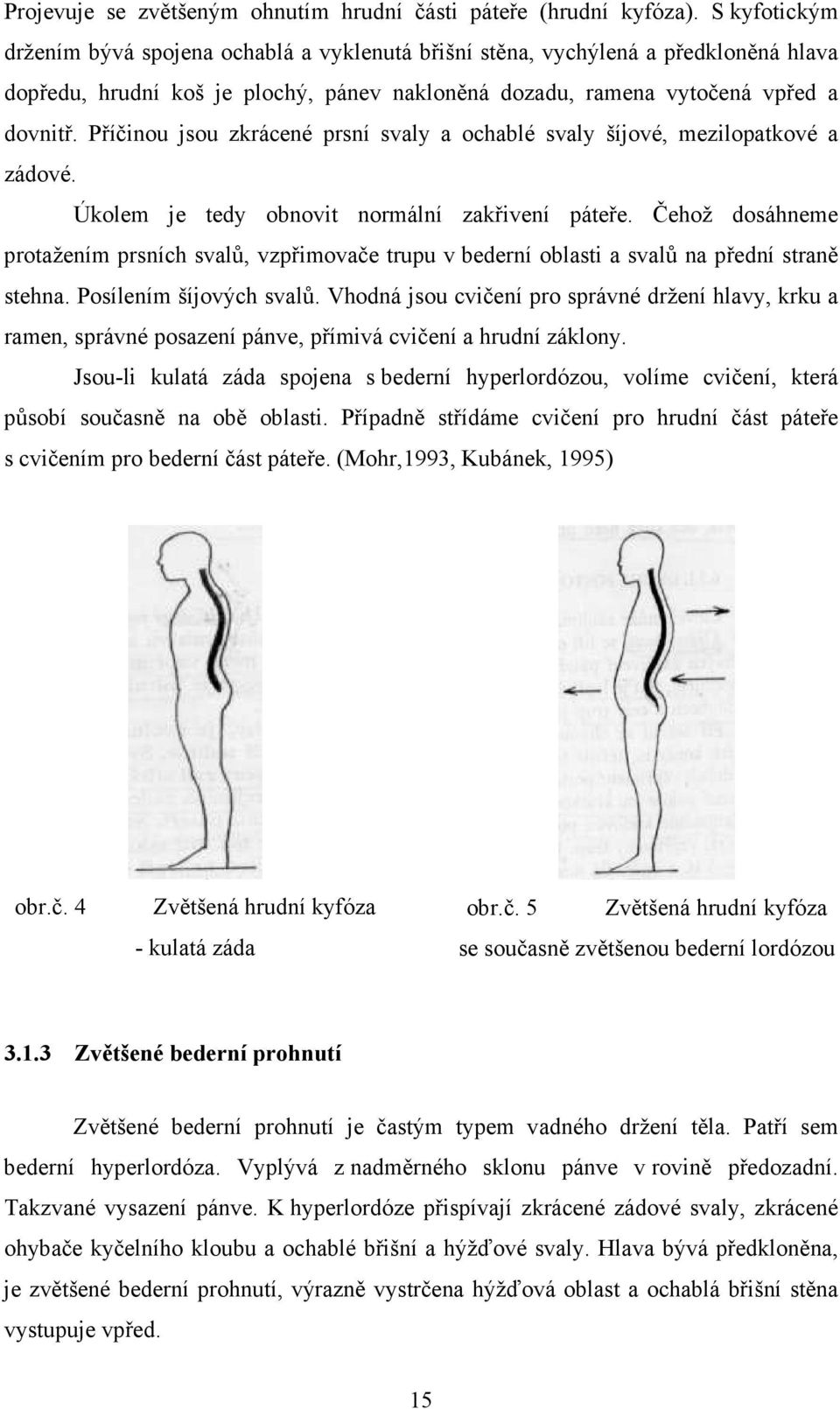 Příčinou jsou zkrácené prsní svaly a ochablé svaly šíjové, mezilopatkové a zádové. Úkolem je tedy obnovit normální zakřivení páteře.