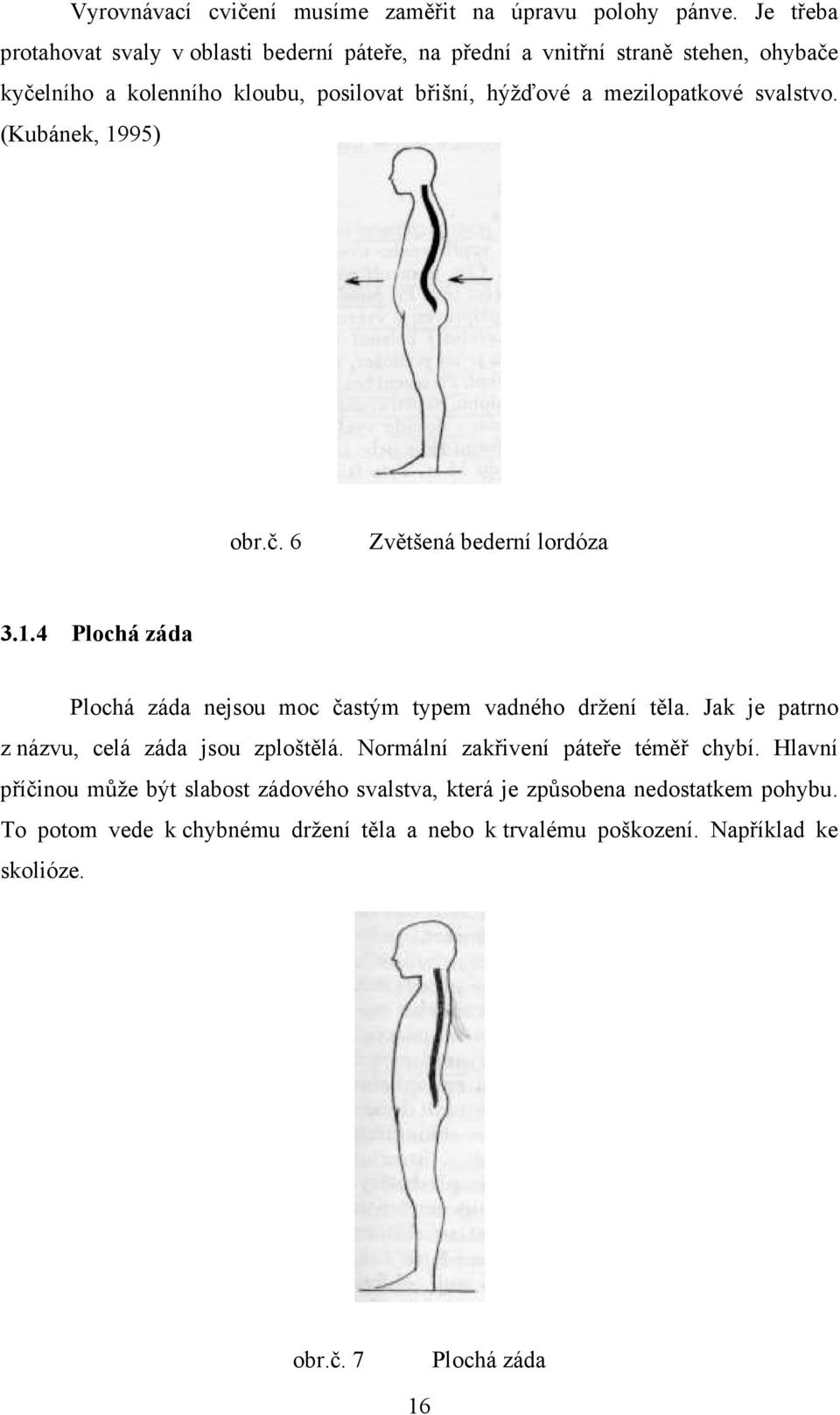 mezilopatkové svalstvo. (Kubánek, 1995) obr.č. 6 Zvětšená bederní lordóza 3.1.4 Plochá záda Plochá záda nejsou moc častým typem vadného držení těla.