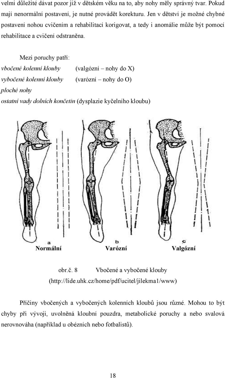 Mezi poruchy patří: vbočené kolenní klouby (valgózní nohy do X) vybočené kolenní klouby (varózní nohy do O) ploché nohy ostatní vady dolních končetin (dysplazie kyčelního kloubu) Normální Varózní