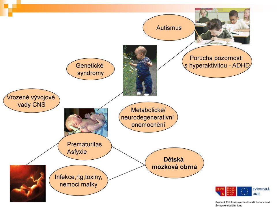 Metabolické/ neurodegenerativní onemocnění