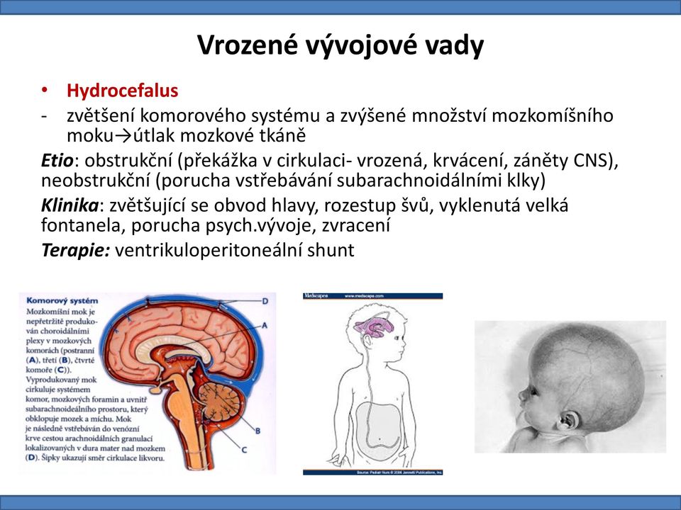 neobstrukční (porucha vstřebávání subarachnoidálními klky) Klinika: zvětšující se obvod hlavy,