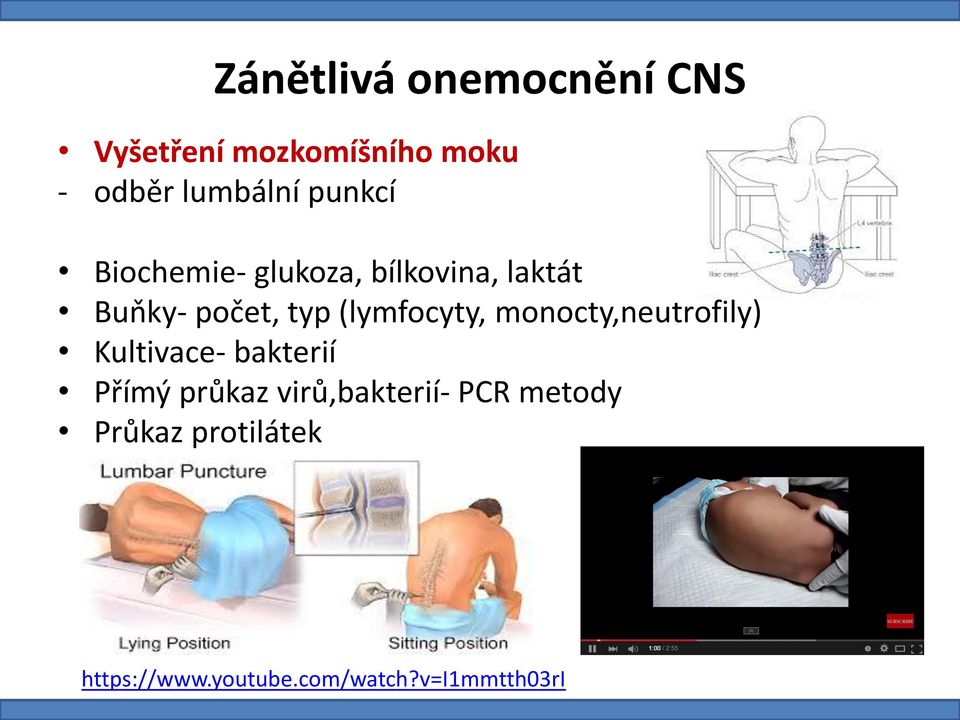 (lymfocyty, monocty,neutrofily) Kultivace- bakterií Přímý průkaz