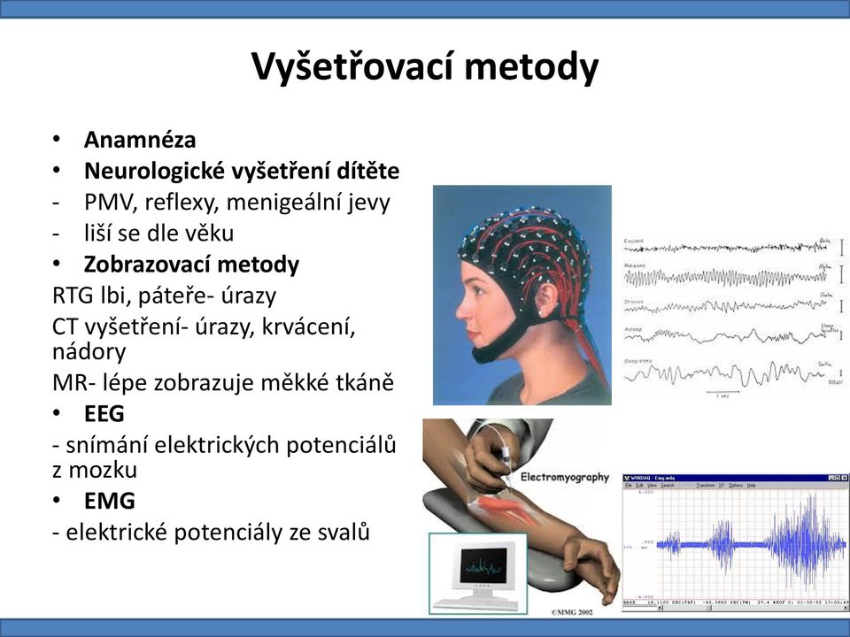 úrazy, krvácení, nádory MR- lépe zobrazuje měkké tkáně EEG - snímání