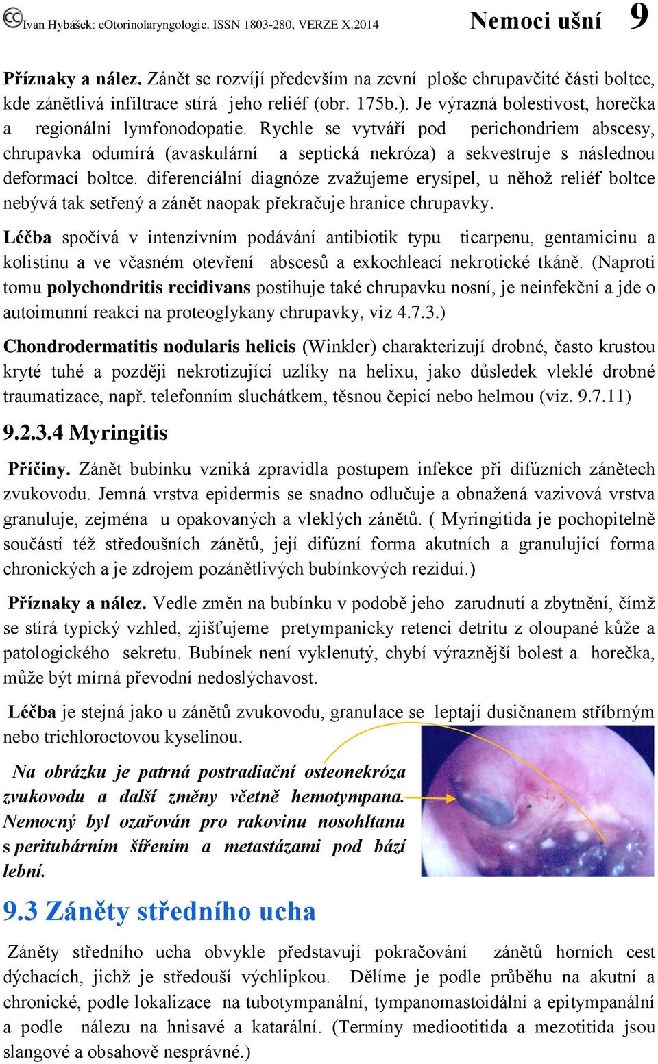 diferenciální diagnóze zvažujeme erysipel, u něhož reliéf boltce nebývá tak setřený a zánět naopak překračuje hranice chrupavky.