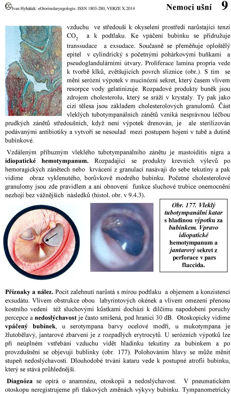 S tím se mění serózní výpotek v mucinózní sekret, který časem vlivem resorpce vody gelatinizuje. Rozpadové produkty buněk jsou zdrojem cholesterolu, který se sráží v krystaly.