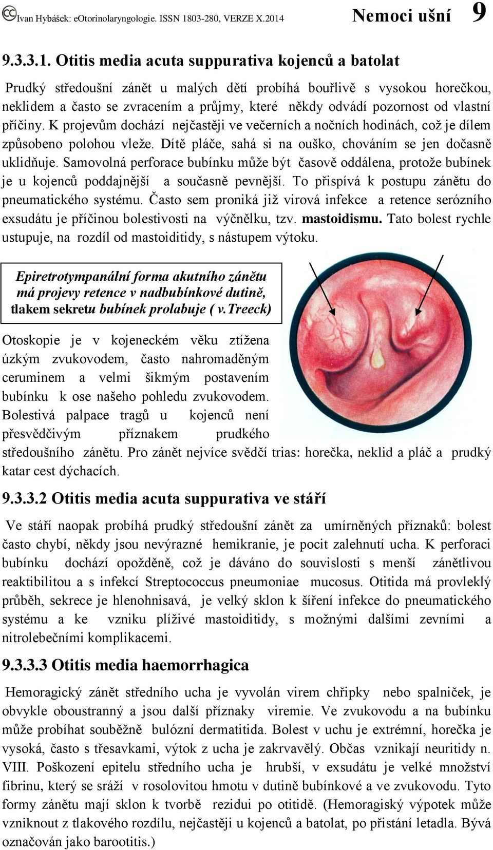 vlastní příčiny. K projevům dochází nejčastěji ve večerních a nočních hodinách, což je dílem způsobeno polohou vleže. Dítě pláče, sahá si na ouško, chováním se jen dočasně uklidňuje.