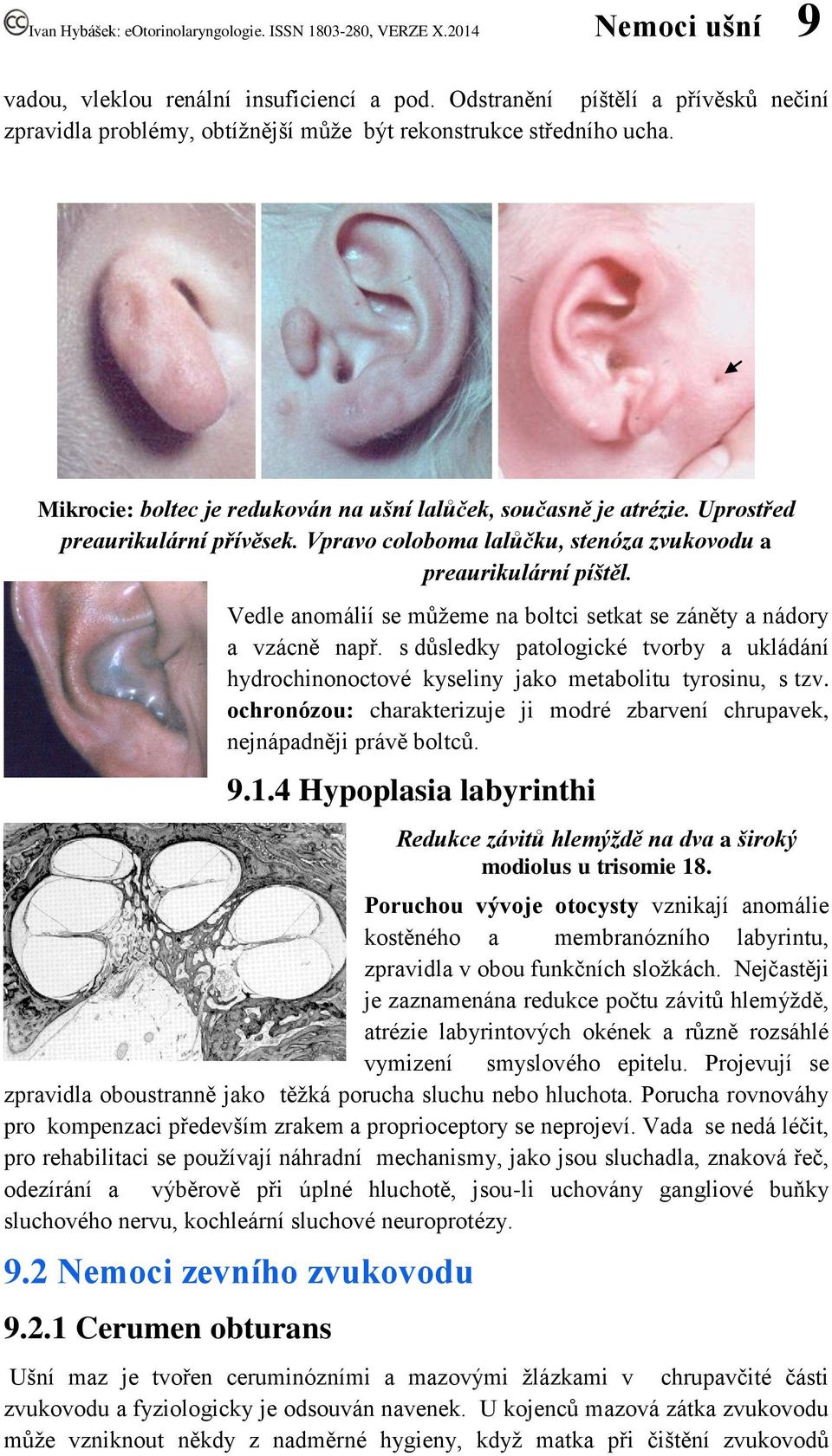 Vedle anomálií se můžeme na boltci setkat se záněty a nádory a vzácně např. s důsledky patologické tvorby a ukládání hydrochinonoctové kyseliny jako metabolitu tyrosinu, s tzv.