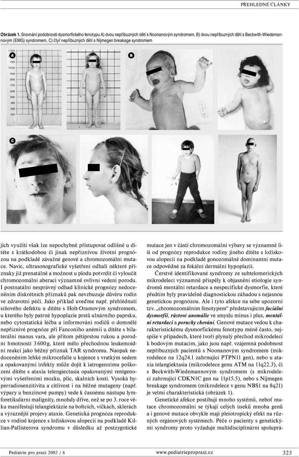 breakage syndromem A B C jich využití však lze nepochybně přistupovat odlišně u dítěte s krátkodobou či jinak nepříznivou životní prognózou na podkladě závažné genové a chromozomální mutace.