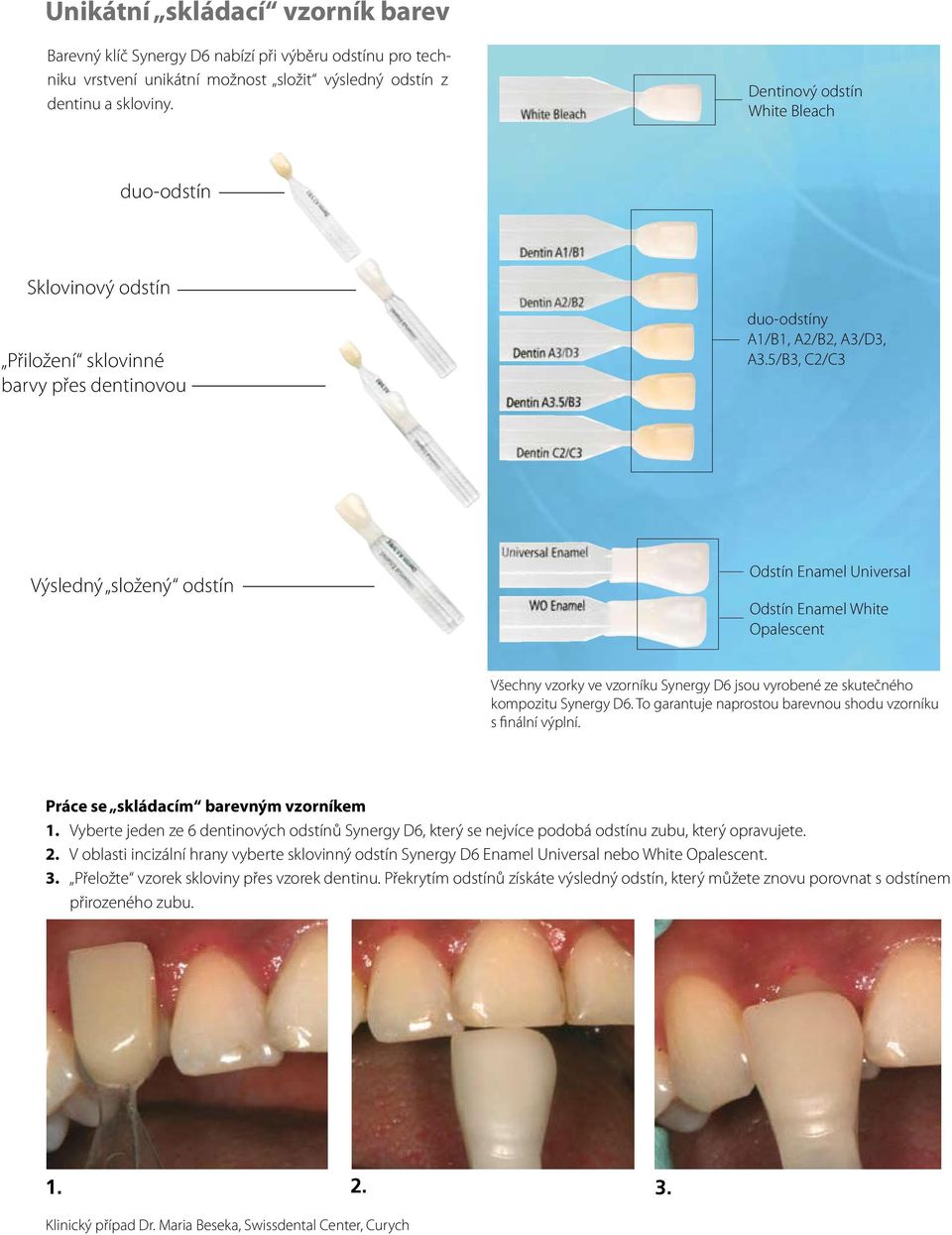 5/B3, C2/C3 Výsledný složený odstín Odstín Enamel Universal Odstín Enamel White Opalescent Všechny vzorky ve vzorníku Synergy D6 jsou vyrobené ze skutečného kompozitu Synergy D6.