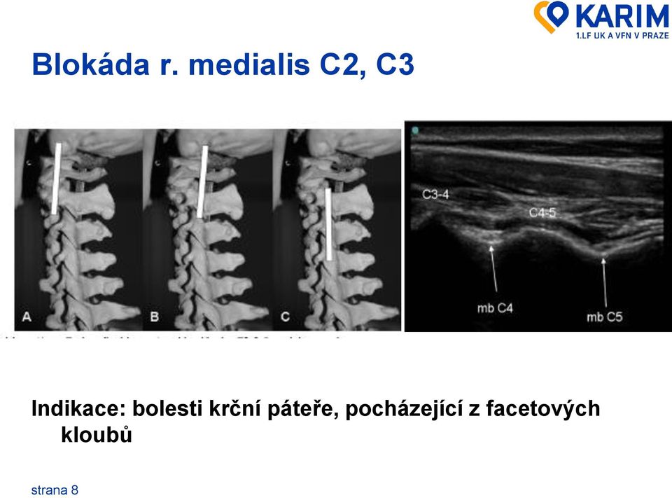 Indikace: bolesti krční