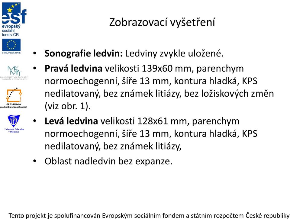 nedilatovaný, bez známek litiázy, bez ložiskových změn (viz obr. 1).