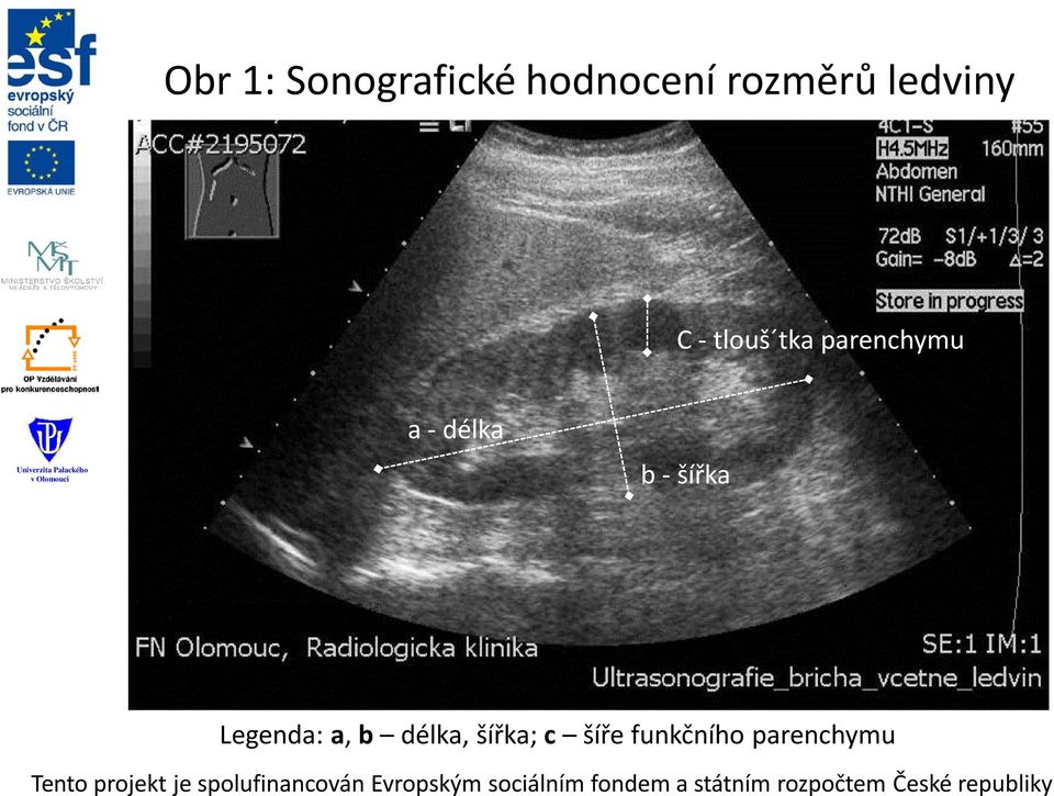 parenchymu a - délka b - šířka