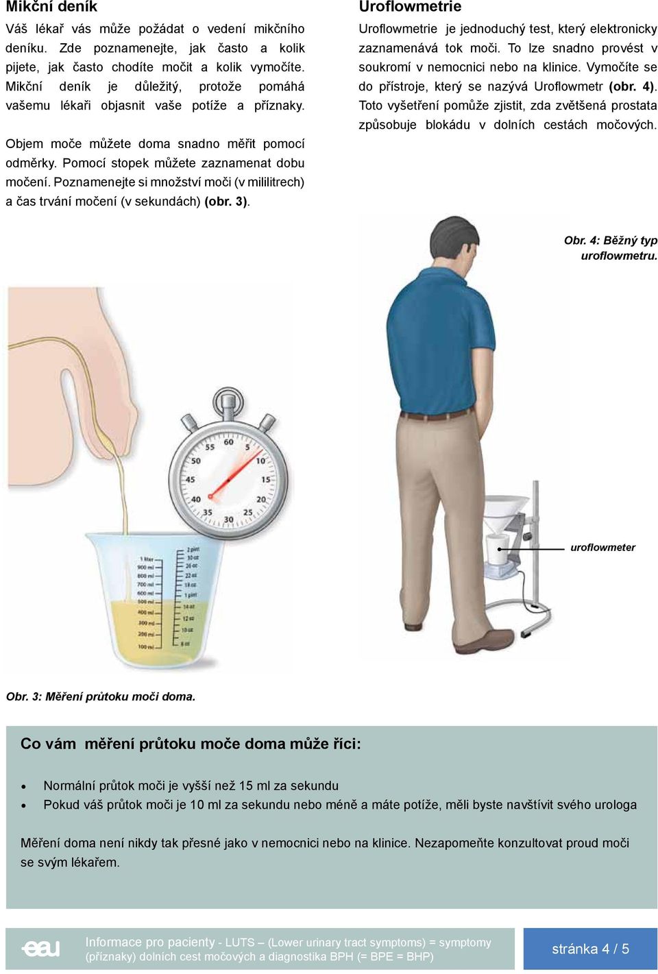 Poznamenejte si množství moči (v mililitrech) a čas trvání močení (v sekundách) (obr. 3). Uroflowmetrie Uroflowmetrie je jednoduchý test, který elektronicky zaznamenává tok moči.