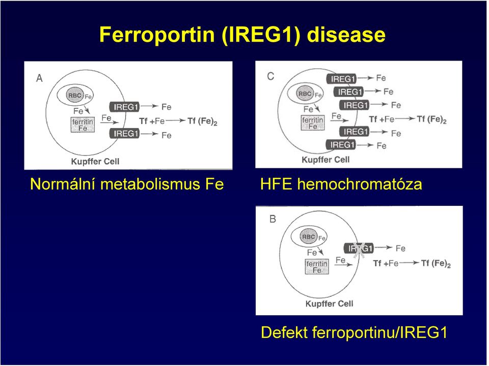 metabolismus Fe HFE