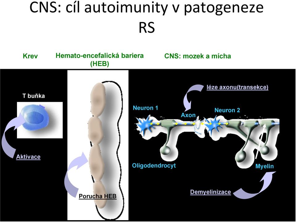 mícha T buňka léze axonu(transekce) Neuron 1 Axon