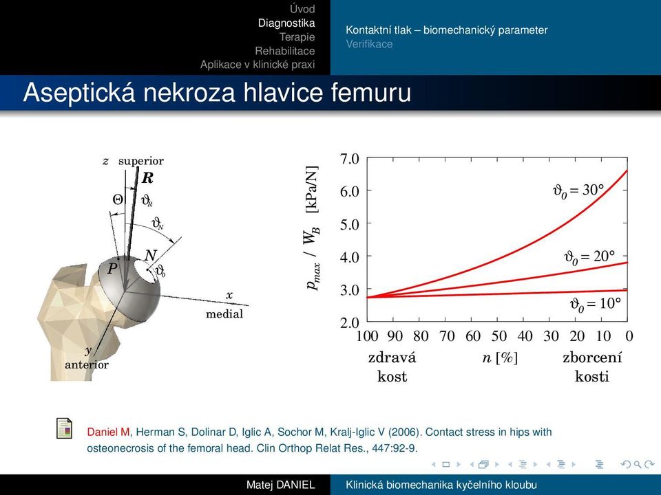 1 ϑ = 1 9 8 7 6 5 4 3 2 1 n [%] zborcení kosti zdravá kost ϑ = 3 ϑ = 2 Daniel M, Herman S, Dolinar D,