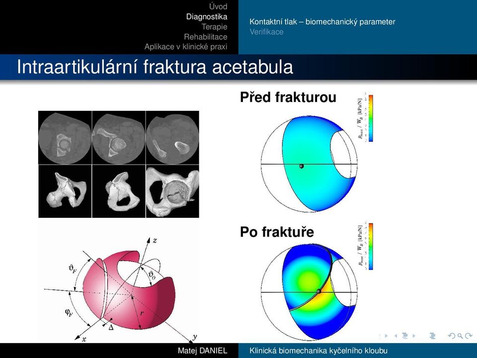 parameter Verifikace Před frakturou