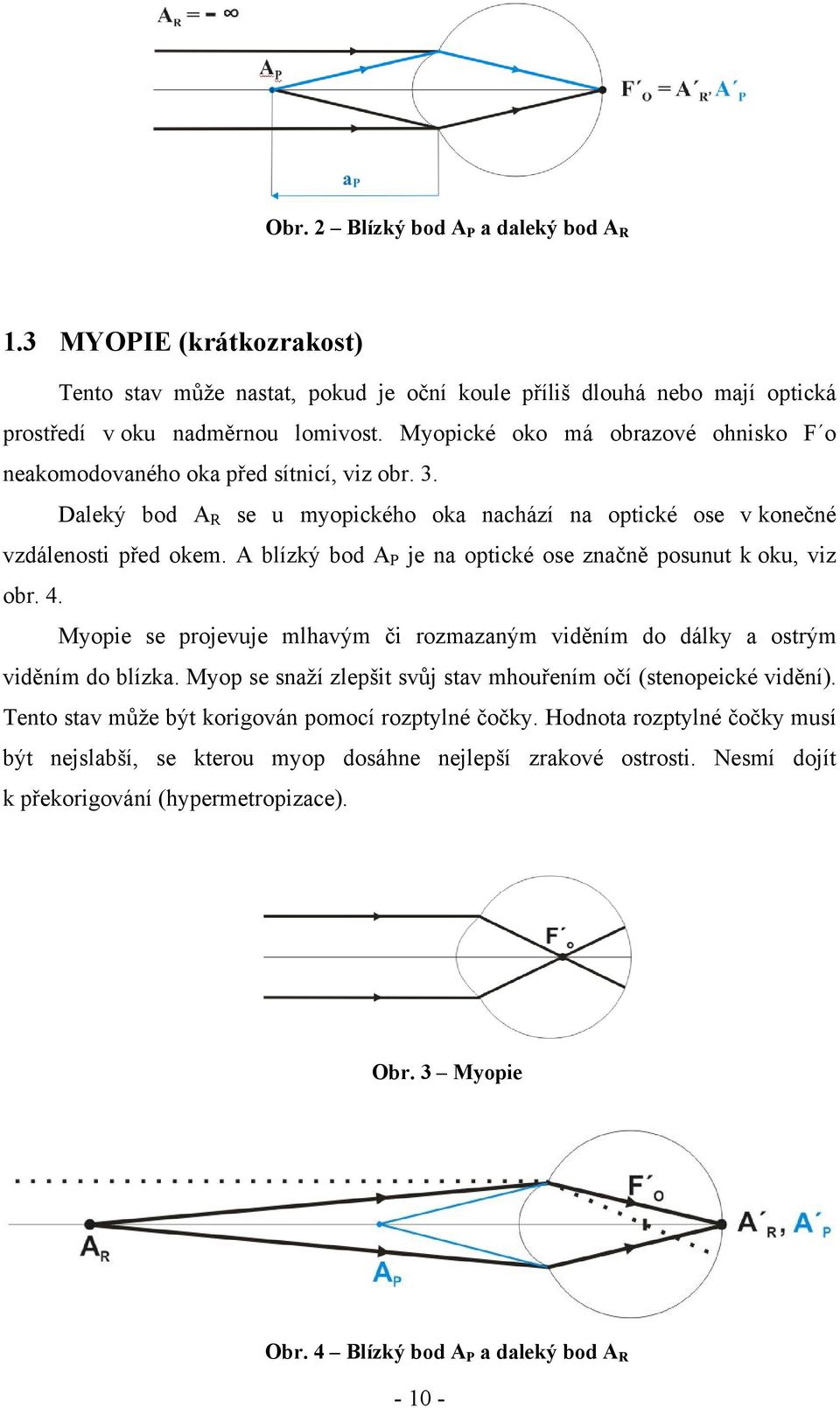 A blízký bod A P je na optické ose značně posunut k oku, viz obr. 4. Myopie se projevuje mlhavým či rozmazaným viděním do dálky a ostrým viděním do blízka.