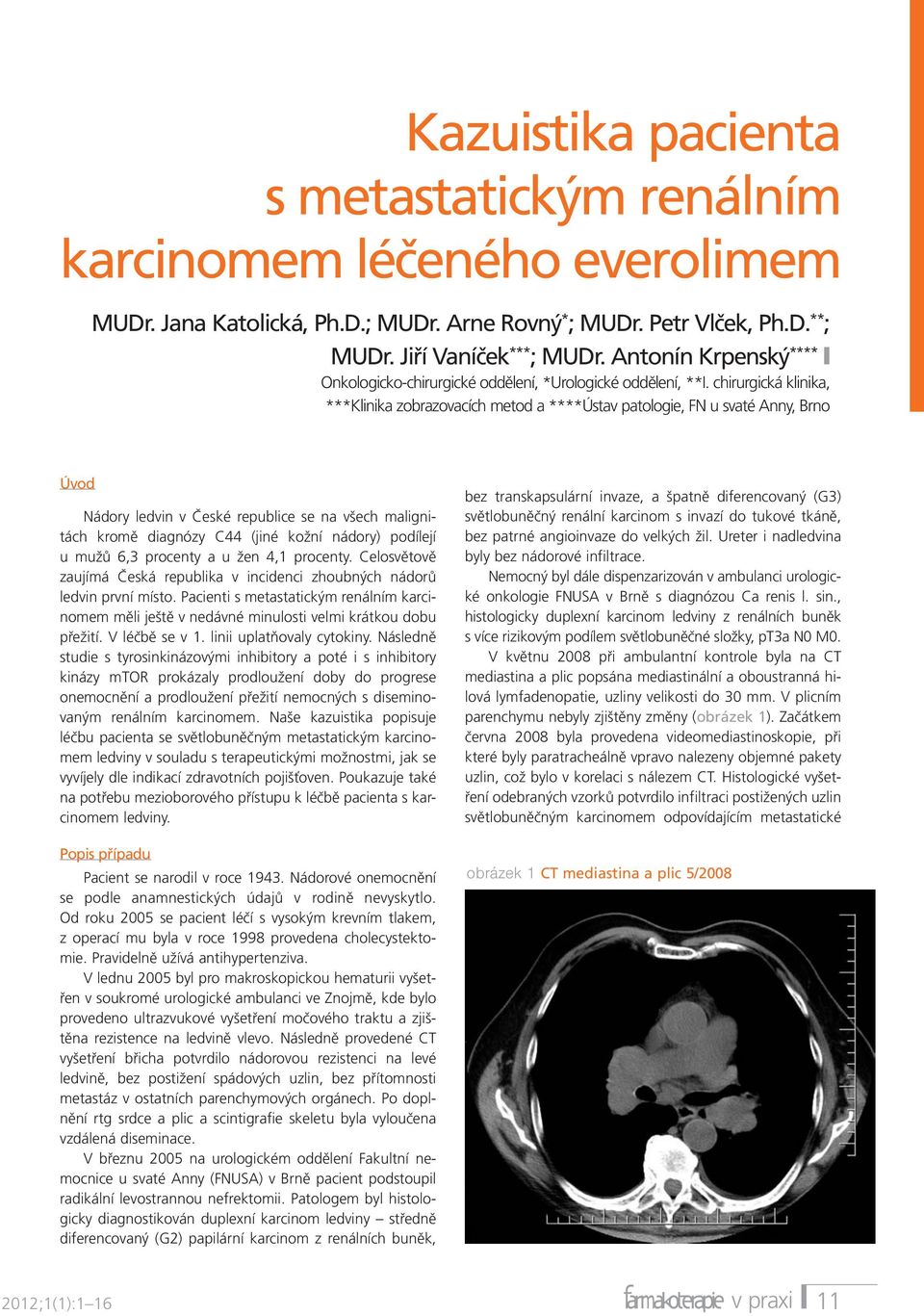 chirurgická klinika, ***Klinika zobrazovacích metod a ****Ústav patologie, FN u svaté Anny, Brno Úvod Nádory ledvin v České republice se na všech malignitách kromě diagnózy C44 (jiné kožní nádory)