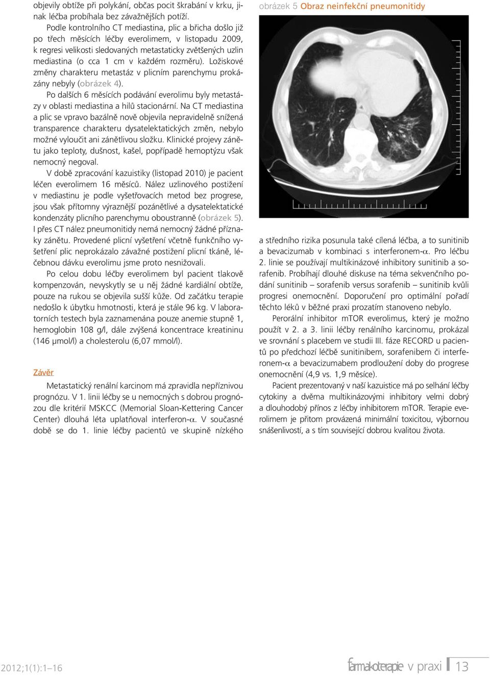 každém rozměru). Ložiskové změny charakteru metastáz v plicním parenchymu prokázány nebyly (obrázek 4). Po dalších 6 měsících podávání everolimu byly metastázy v oblasti mediastina a hilů stacionární.