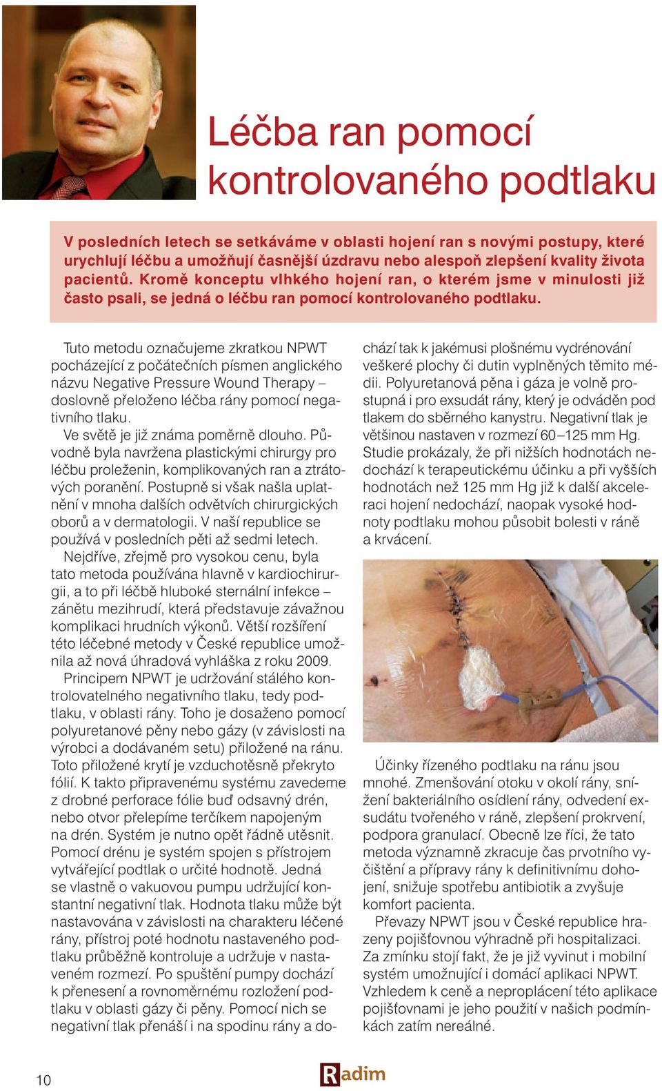 Tuto metodu označujeme zkratkou NPWT pocházející z počátečních písmen anglického názvu Negative Pressure Wound Therapy doslovně přeloženo léčba rány pomocí negativního tlaku.